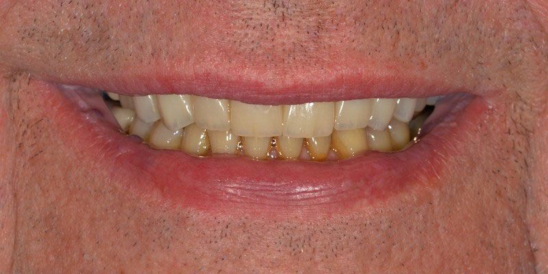 smile-gallery-4-after.jpg